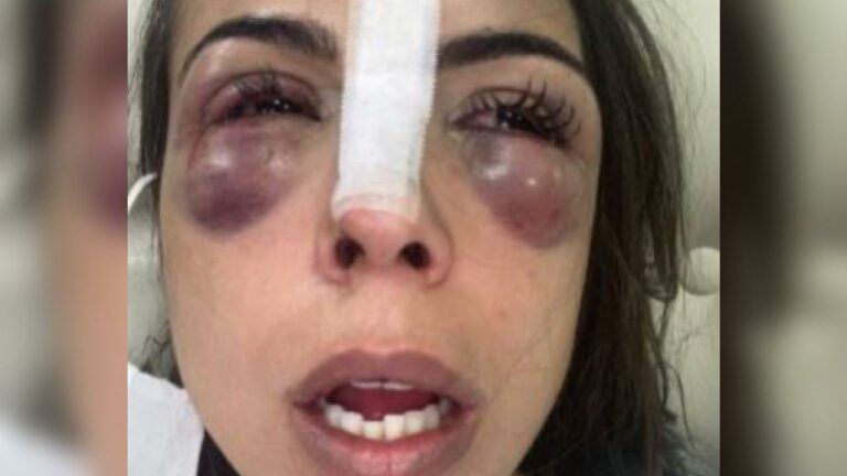 Arquiteta agredida por trs homens no RJ